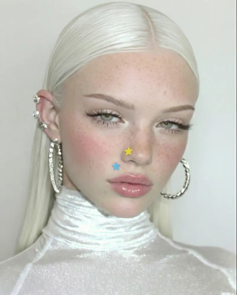 Acne After Hydrocolloid Treatment